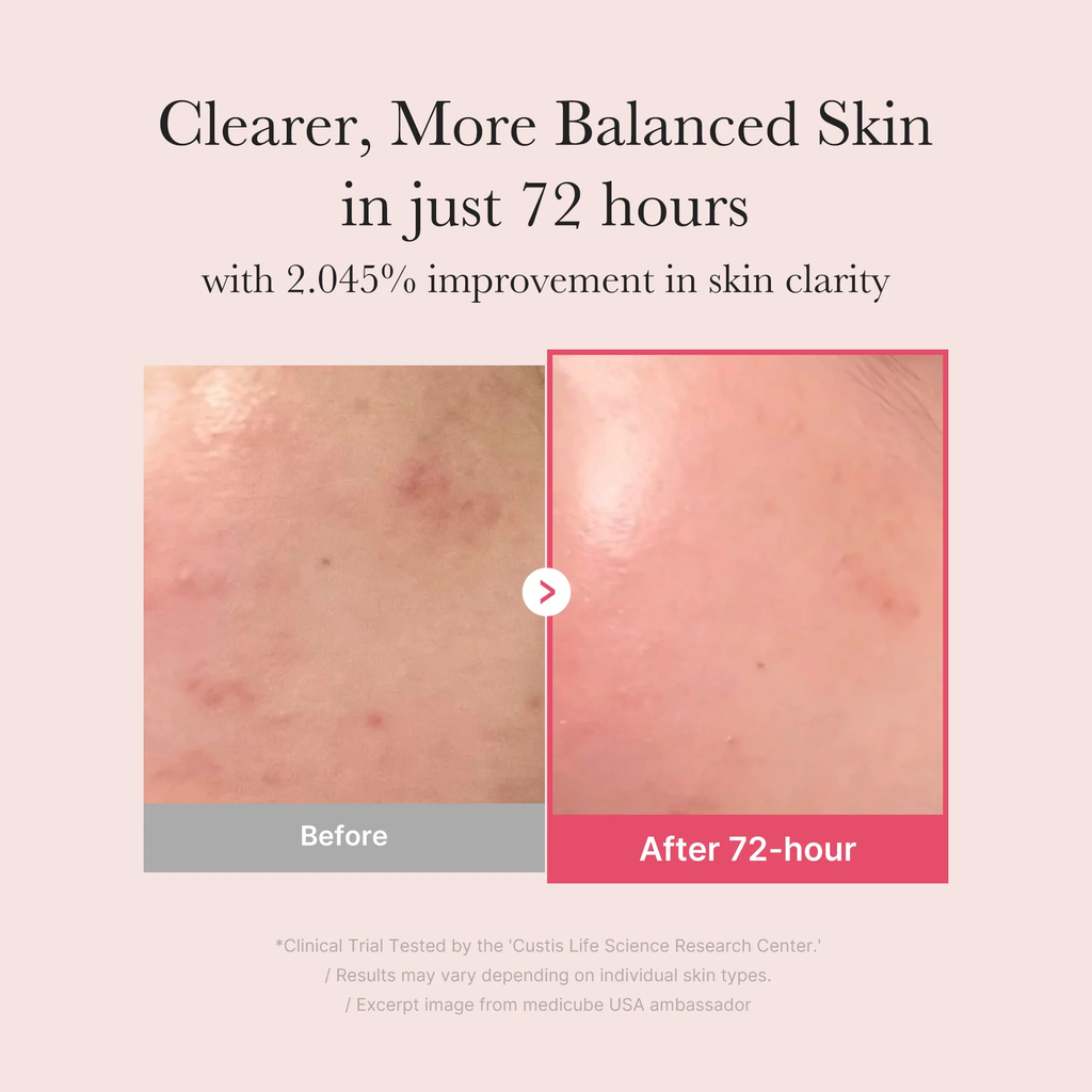 Medicube TXA Niacinamide Serum 30ml detail image