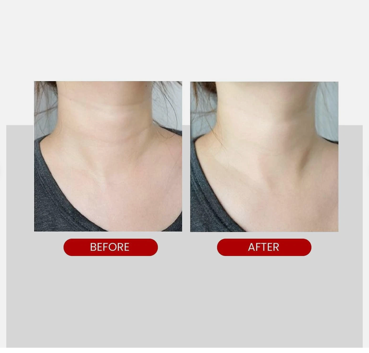 MEDI-PEEL Naite Thread Neck Cream – 100 mL detail image